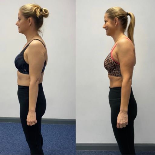 Antes e Depois Maria Antonia Mendes