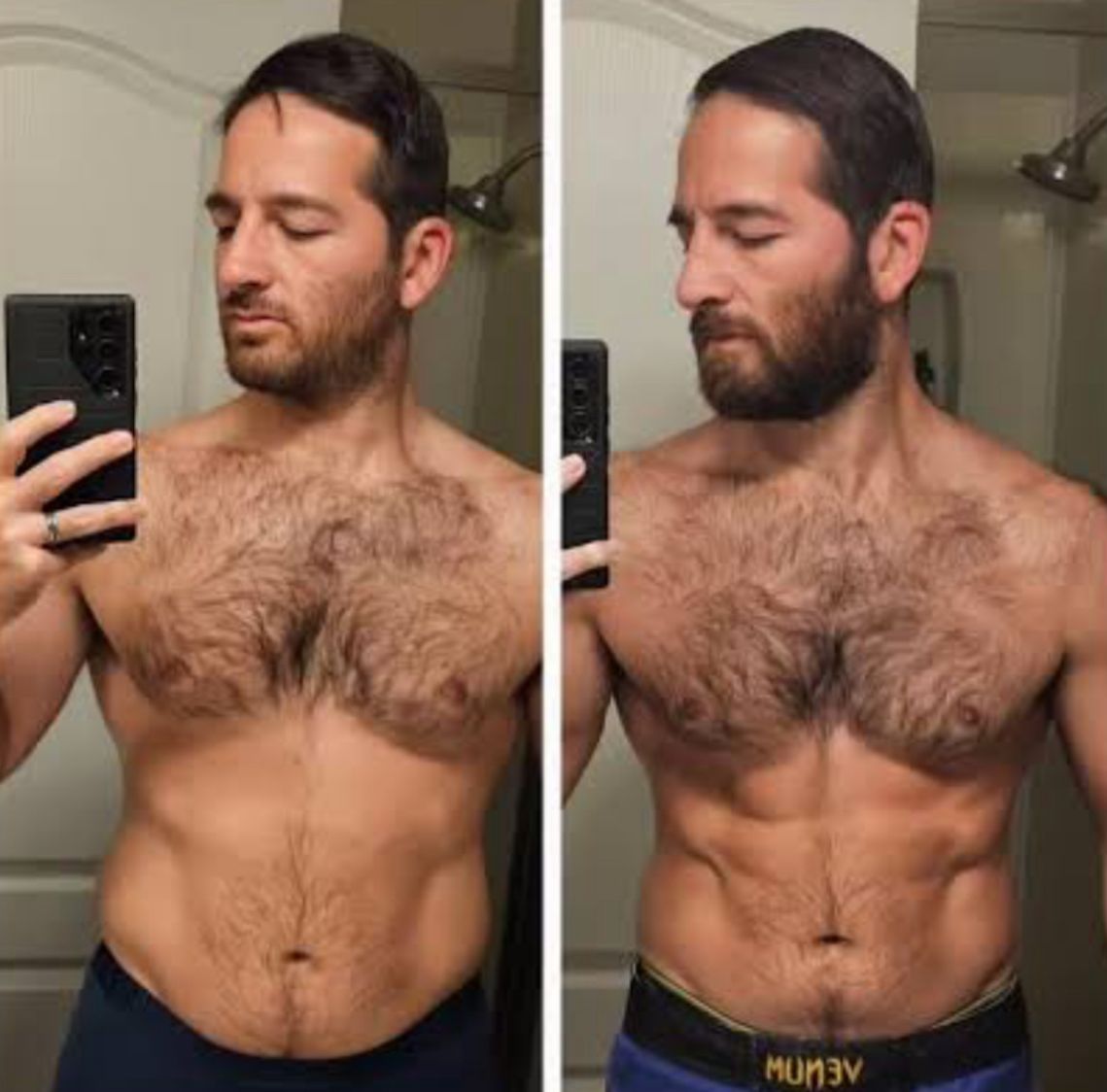 Antes e Depois Carlos